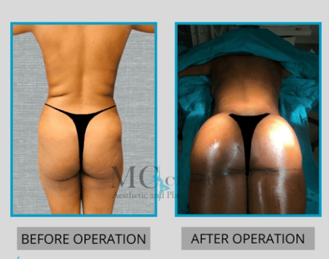 Slider image (5) MEHMET CEBER CLINIC